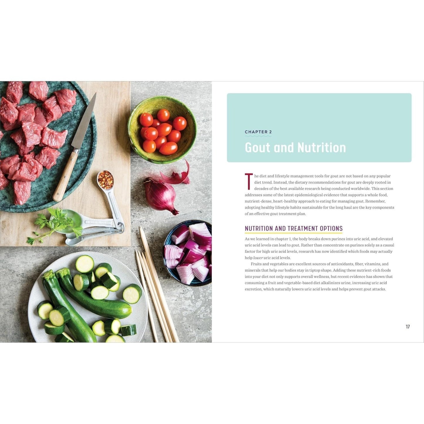 The 28-Day Gout Diet Plan: The Optimal Nutrition Guide to Manage Gout (Spiral Bound)