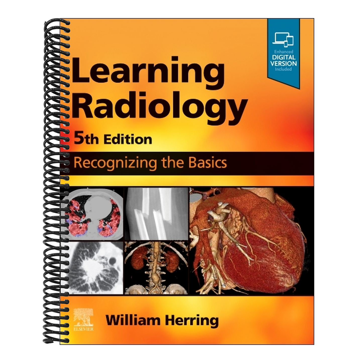 Learning Radiology: Recognizing the Basics