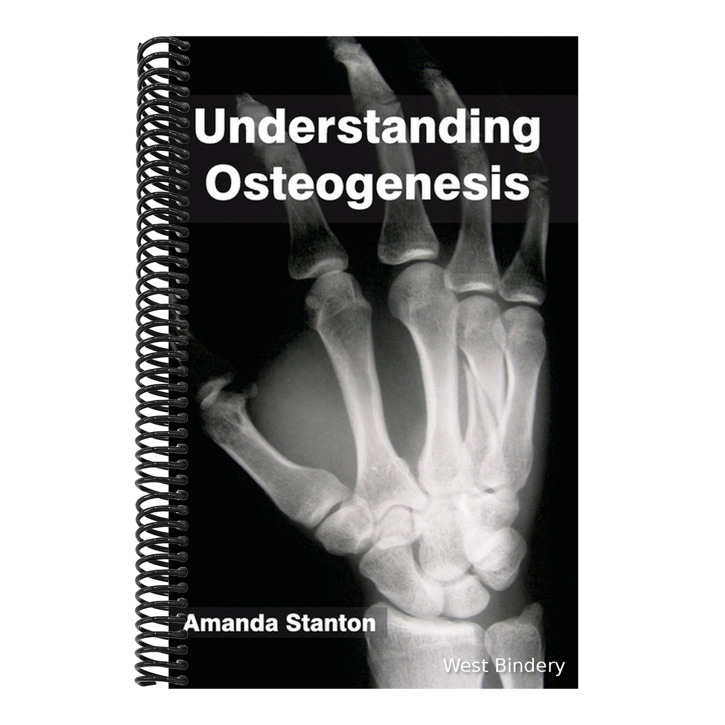 Understanding Osteogenesis