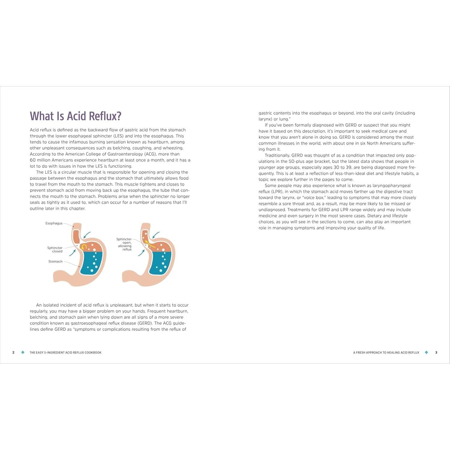 The Easy 5-Ingredient Acid Reflux Cookbook: Fuss-Free Recipes for Relief from Gerd and Lpr