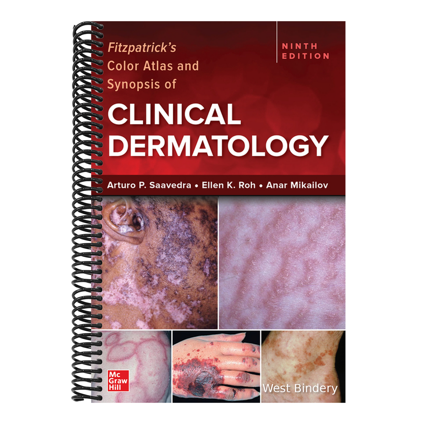 Fitzpatrick's Color Atlas and Synopsis of Clinical Dermatology, Ninth Edition