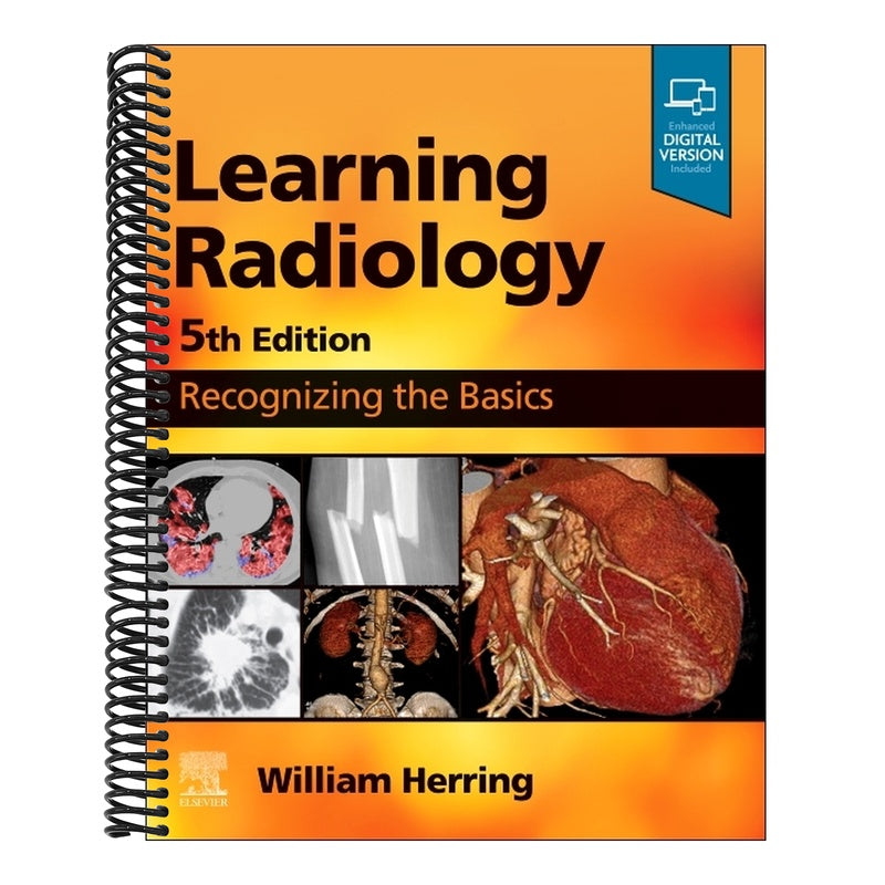 Learning Radiology: Recognizing the Basics