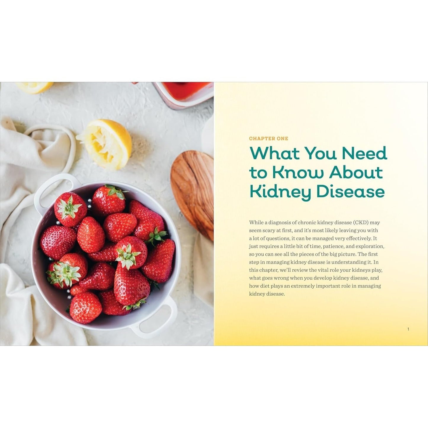 Renal Diet Cookbook for the Newly Diagnosed: The Complete Guide to Managing Kidney Disease and Avoiding Dialysis (Spiral Bound)